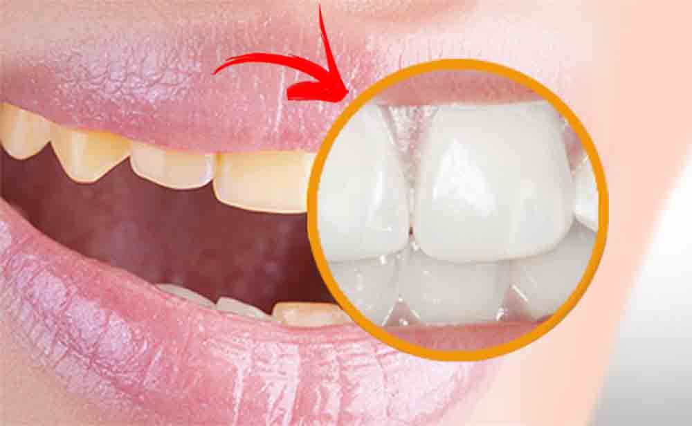 Denti bianchissimi: il segreto è quest’ingrediente, ce l’hai in cucina | Costa appena 1 euro (lo consigliano anche i dentisti)