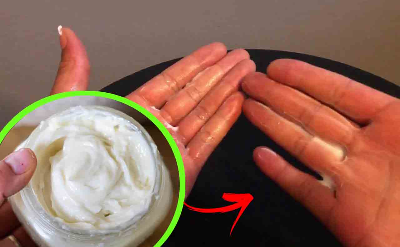 Macchie sulle mani: metti questa crema, le elimina a costo 0!