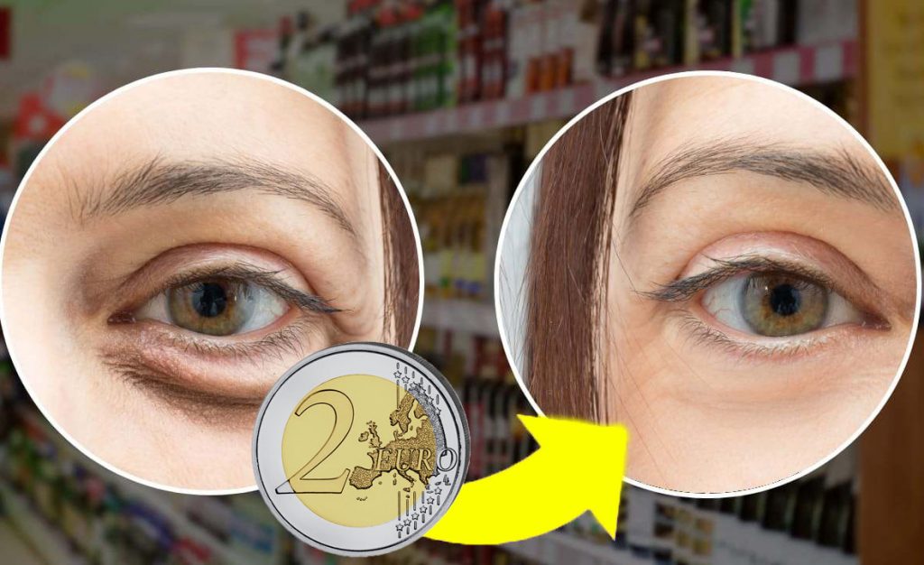 Lidl, donne in fila alle casse: questi prodotti per il viso all’acido ialuronico sono in offerta a pochi euro. Fai la scorta!