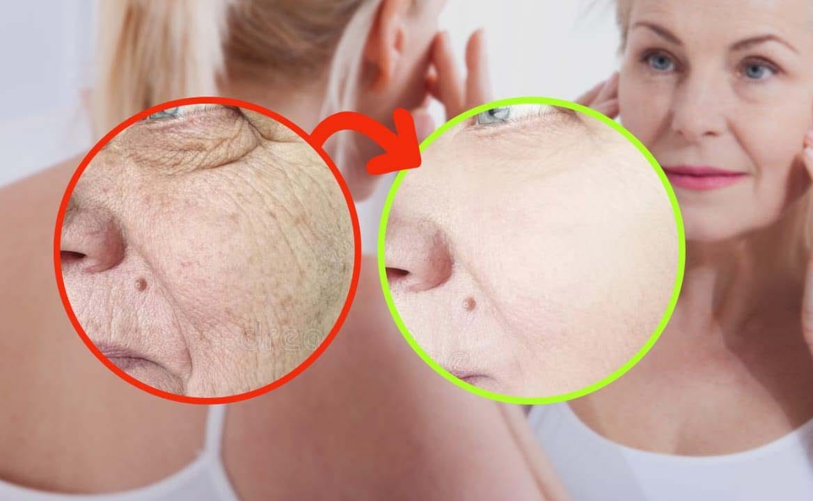 Pelle invecchiata? Spalma 3 gocce di quest'olio sul viso e ringiovanisci 10 anni!