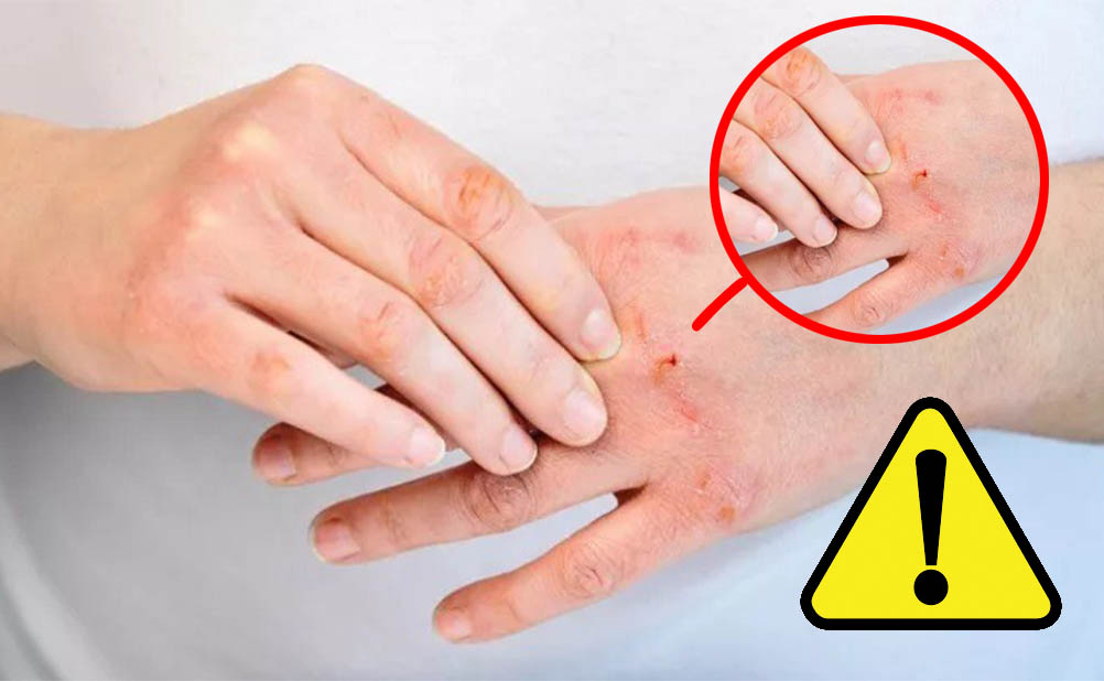 Vitamina B12, fai attenzione! Questi segni su mani e bocca ti indicano che hai una carenza gravissima, ma pochi lo sanno!