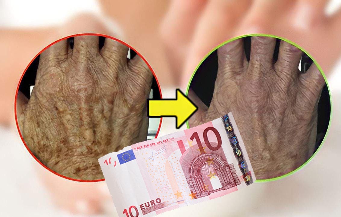 Macchie scure, applica subito questo siero: lo trovi in questo discount a soli 10,99 euro!