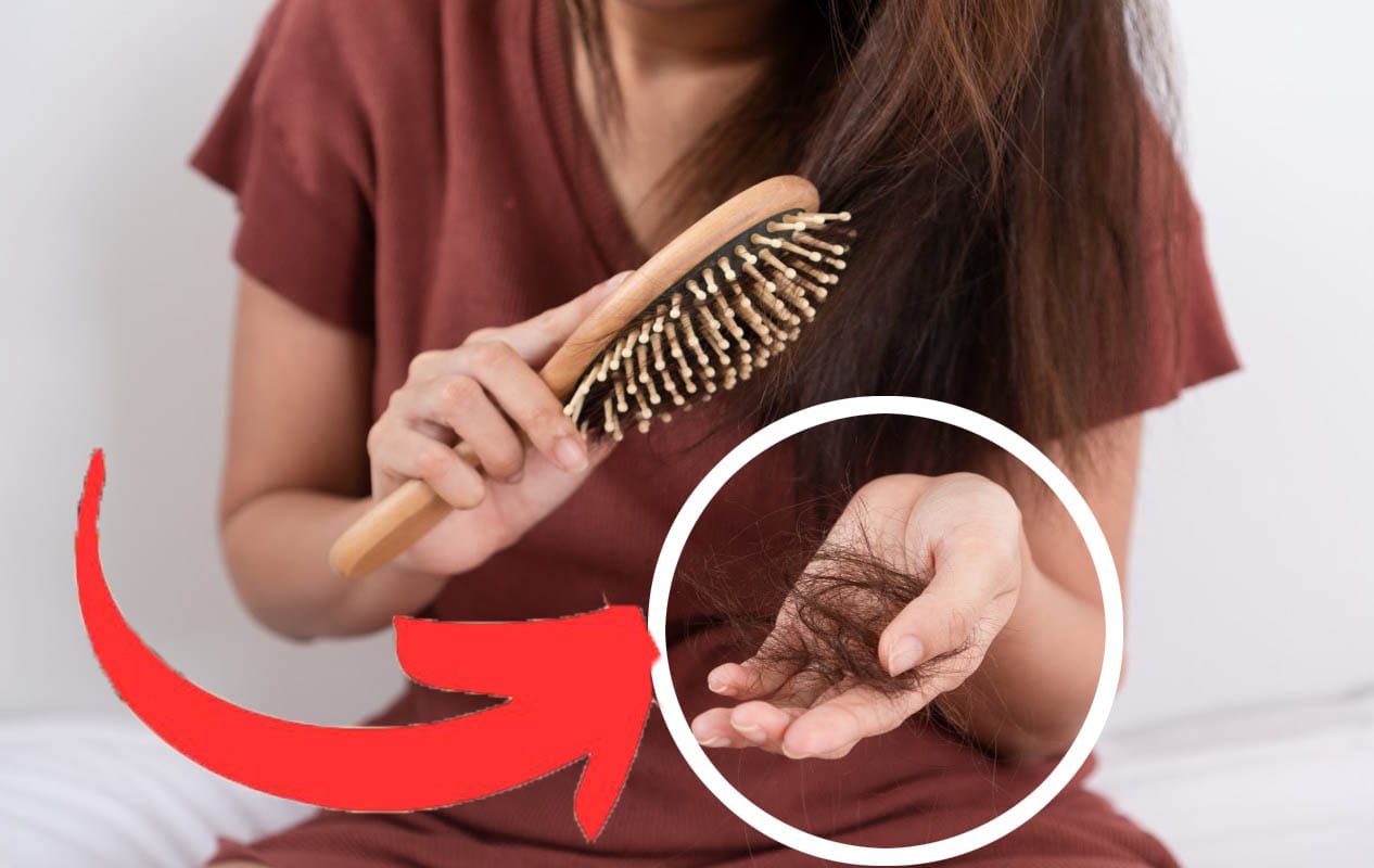 Perdita dei capelli, non lo sai: