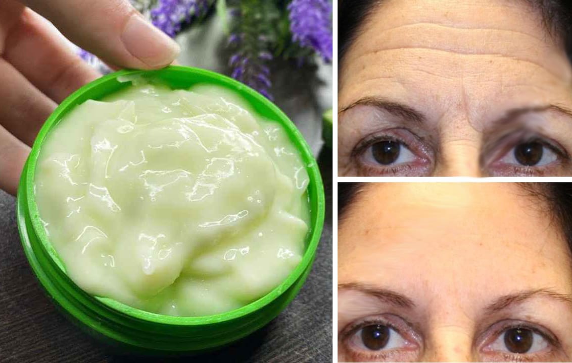Crema viso al collagene, è una potenza: niente rughe e pelle giovane!