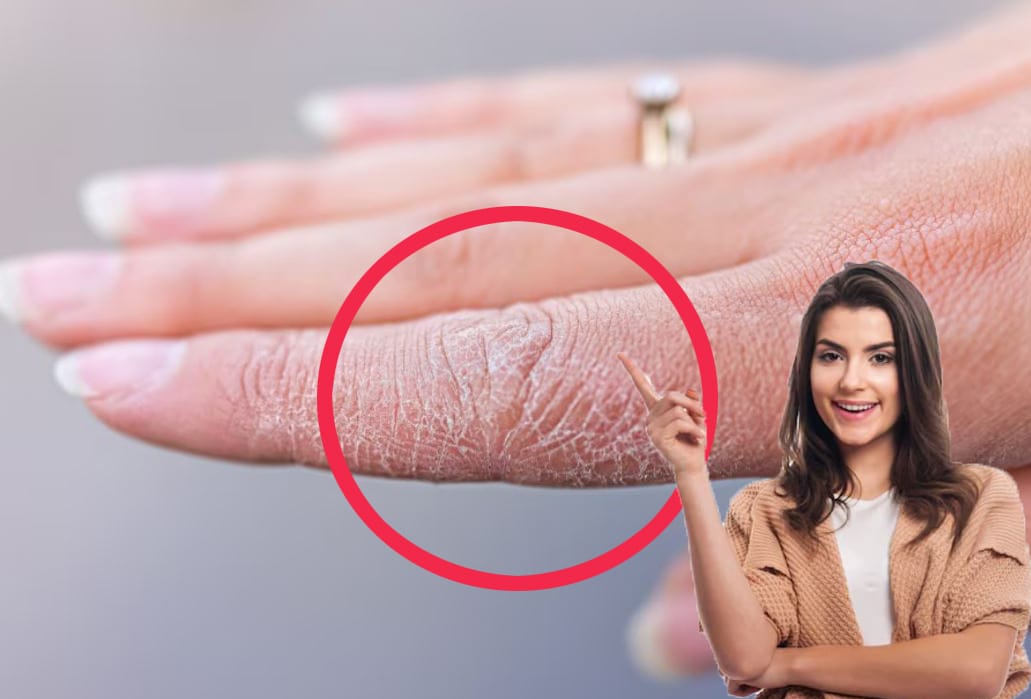 Mani secche e screpolate per il freddo, non funzionava niente: poi ho risolto così!