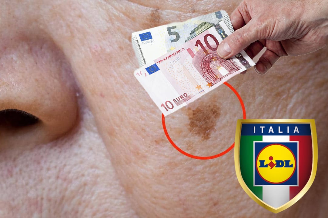 Macchie sul viso crema Lidl